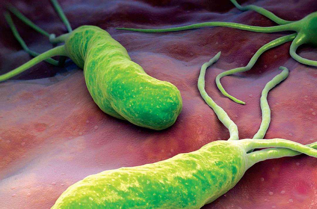沪男子染幽门螺杆菌致全家老小阳性，感染这种病菌会出现哪些症状？